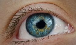 KATARAK KÖRLÜK NEDENLERİNİN BAŞINDA GELİYOR
