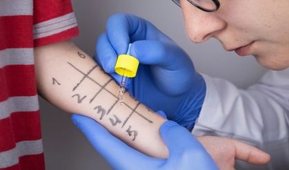 Çocuklarınızı Alerjiye Karşı Bu 7 Adımla Koruyun